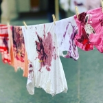 Արյունոտ լվացք՝ Տորոնտոյում. լուսանկարներ 